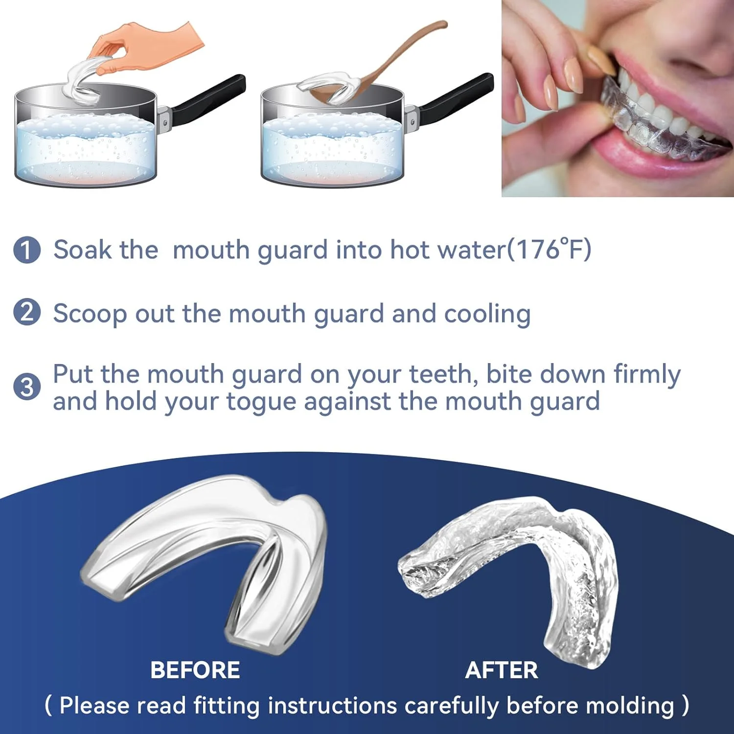 Protège-dents malléable pour dents